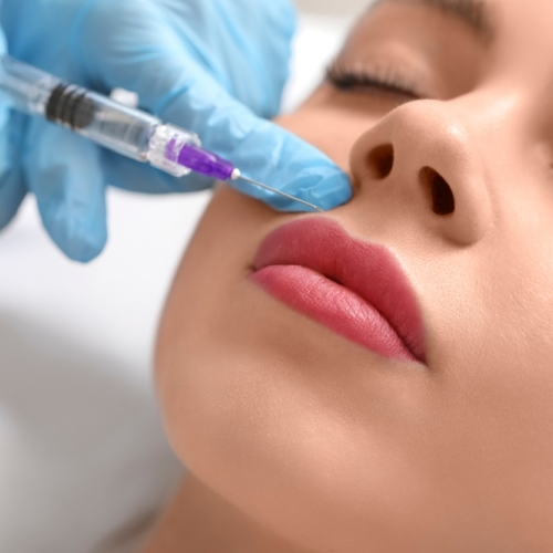 Lip filler nær Aalborg med fokus på balanceret resultat