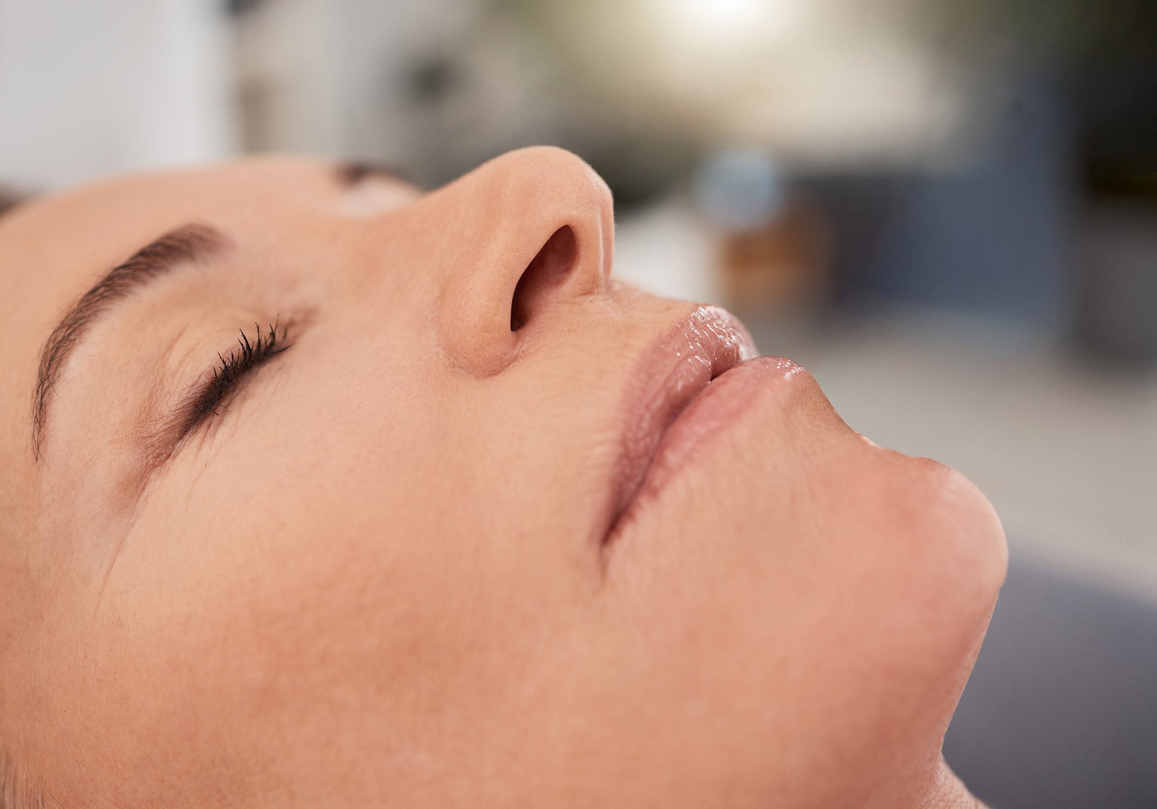 Microneedling med SkinPen nær Aalborg og Viborg udført på klinik i Aars